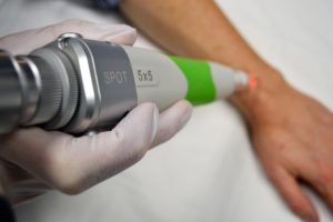 pigmented lesion removal, age spot removal